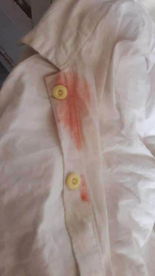 مزيل البقع الاقوي من شركه مكه