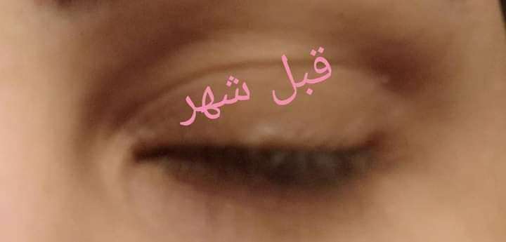 سيرم اطالة الرموش والحواجب من مكه