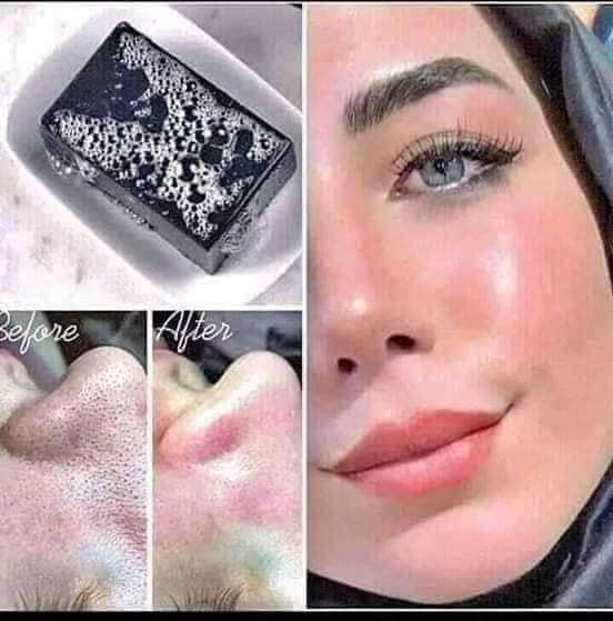 صابونة الفحم النشط