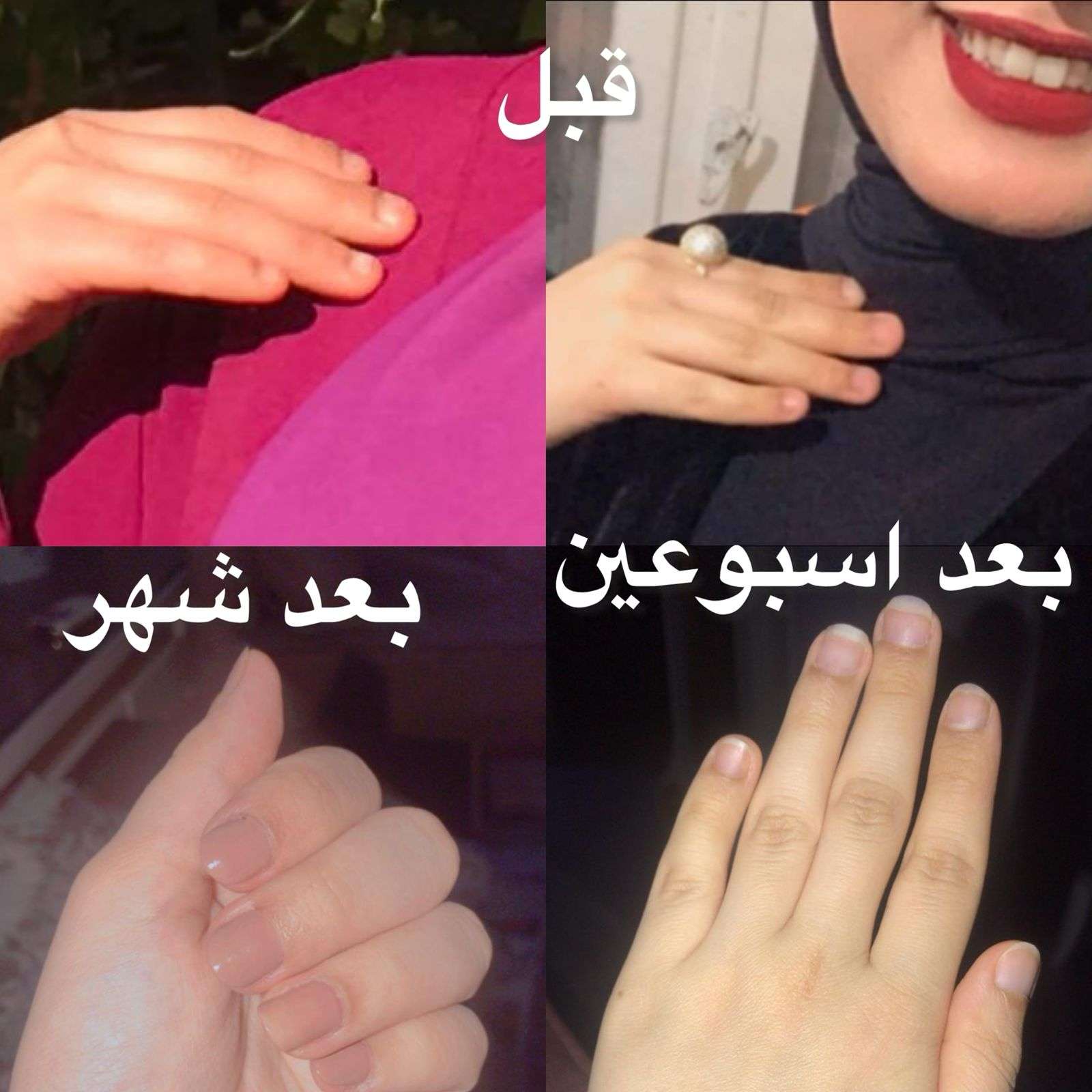 سيرم لتقويه وإطالة الأظافر