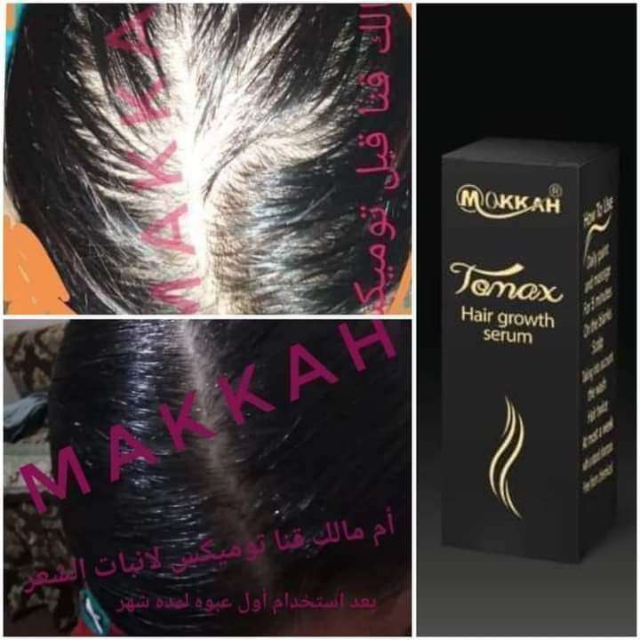 لاجو بلاج الجديد تومكس