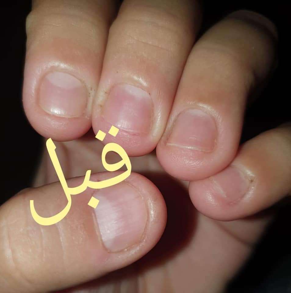 سيرم تقوية الأظافر