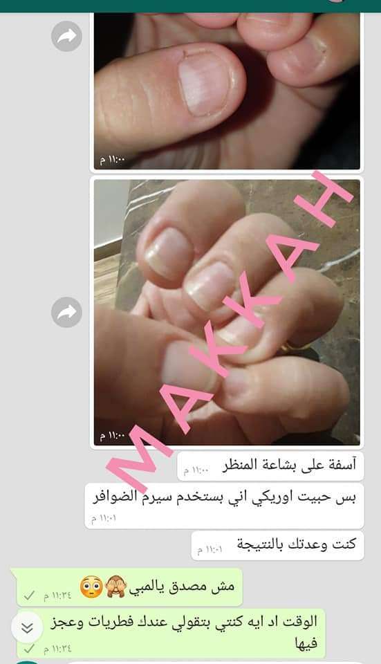 سيرم تقوية الأظافر