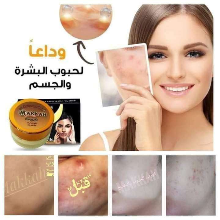 جل الحبوب العلاجي