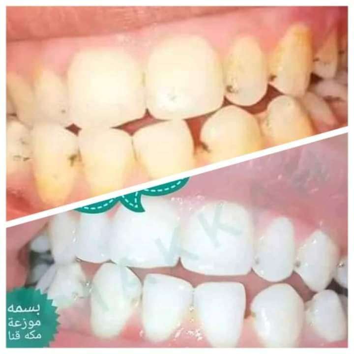 معجون مكة لتبييض الأسنان ٣٠جم