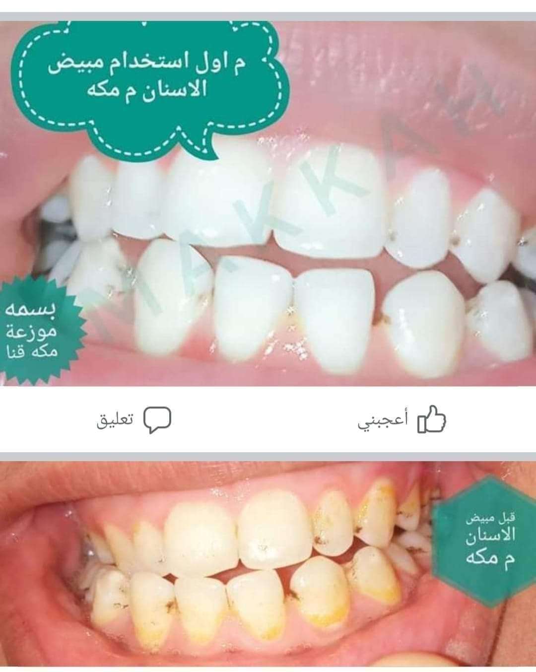 معجون مكة لتبييض الأسنان ٣٠جم