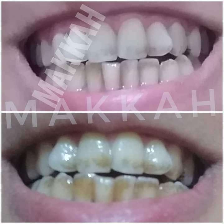 معجون مكة لتبييض الأسنان ٣٠جم