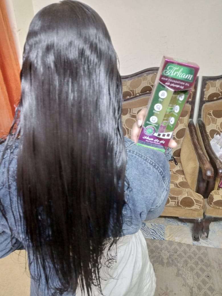 زيت شعر ارقام