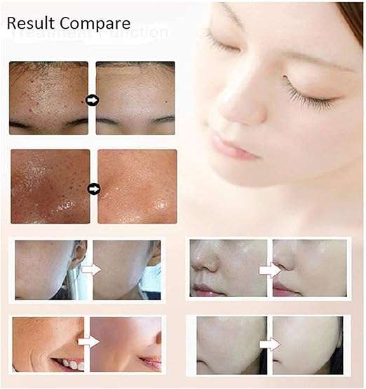 قناع الوجه المضاد للشيخوخة باضاءة LED من 7 الوان لتجديد البشرة