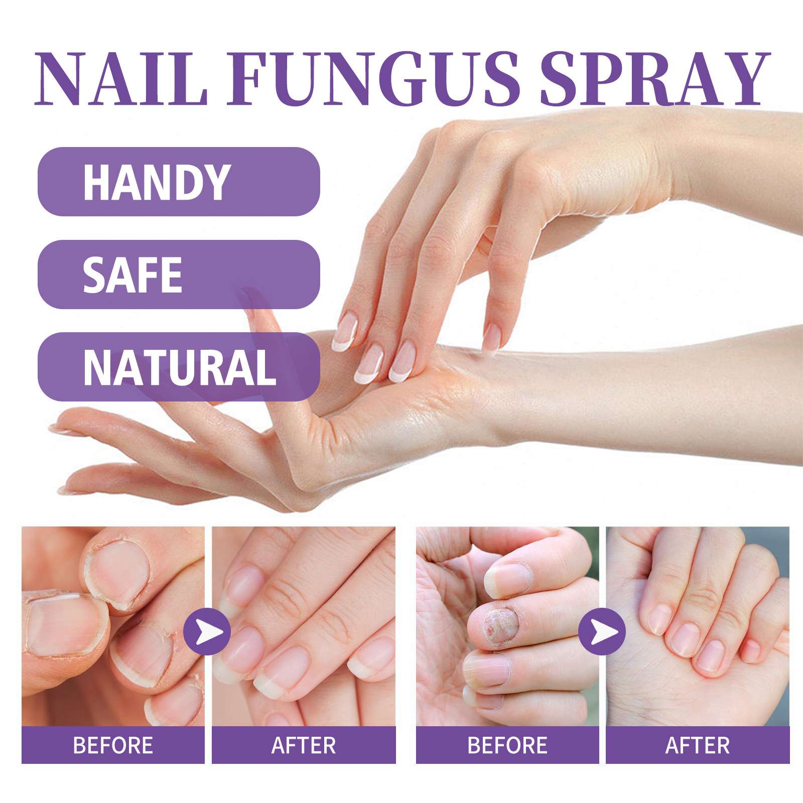 NAIL FANGUS SPRAY